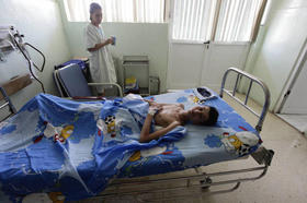 Un joven reposa en una camilla tras ser operado en el Centro Cardiaco Infantil William Soler, en La Habana, en octubre de 2013