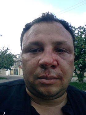 El periodista independiente Roberto de Jesús Guerra, director de Hablemos Press, golpeado en Cuba