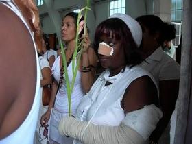 La Dama de Apoyo Sonia Garro Alfonso, luego de ser golpeada por la policía castrista
