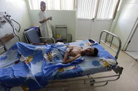 Un joven reposa en una camilla tras ser operado en el Centro Cardiaco Infantil William Soler, en La Habana, en octubre de 2013. Un joven reposa en una camilla tras ser operado en el Centro Cardiaco Infantil William Soler, en La Habana, en octubre de 2013