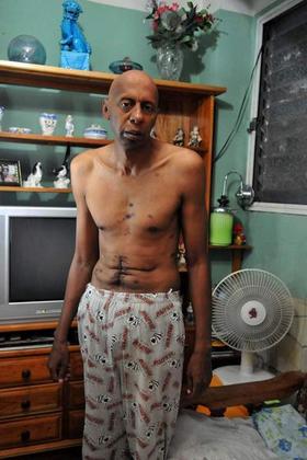 El opositor Guillermo Fariñas en su casa hoy viernes 10 de junio de 2011, en Santa Clara. (EFE)