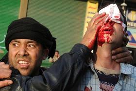 Un hombre trata de contener la sangre de la herida de un joven manifestante. Un hombre trata de contener la sangre de la herida de un joven manifestante