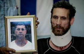 Ariel Sigler, habla con periodistas después de salir del hospital donde se encontraba preso en Pedro Betancourt, 12 de junio 2010. La fotografía colocada al lado muestra su estado antes de ser arrestado